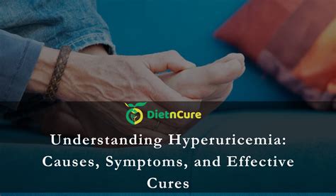 Understanding Hyperuricemia: Causes, Symptoms, and Effective Cures - Dietncure