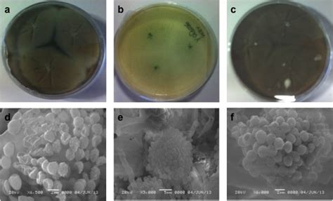 Identificación Morfológica De Aspergillus Sp Colonias En Czapek 25 ºc Download Scientific