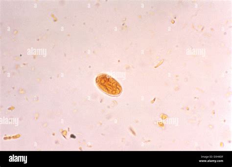 GIARDIA LAMBLIA Stock Photo - Alamy