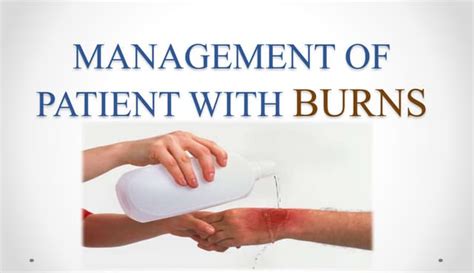 Management Of Patient With Burns Ppt