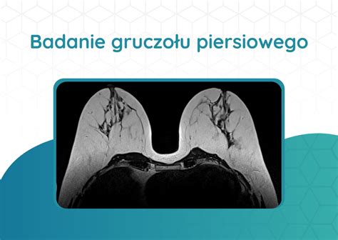 Rezonans Magnetyczny Badanie Gruczo U Piersiowego Pp Diagnostyka