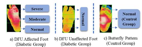 Labelling Of Thermogram Regions Depicting Relative Temperature At Download Scientific Diagram