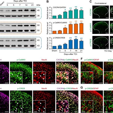 Intrathecal Injection Of Cxcr Sirna Attenuates Tci Induced Cancer Pain