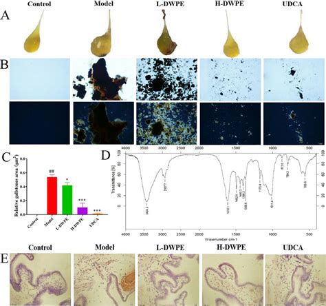 Effect Of Dwpe On Gallstones Formation In Different Groups A