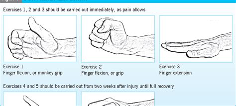 Managing boxer's fracture: a literature review. - Semantic Scholar