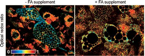 Figure 1 From Evaluating Cell Metabolism Through Autofluorescence