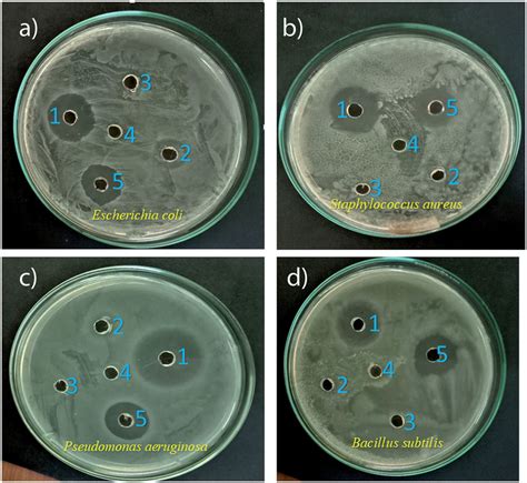 Antibacterial Activity Of Synthesized Silver Nanoparticles Against