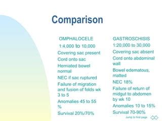 229688251 omphalocele | PPT