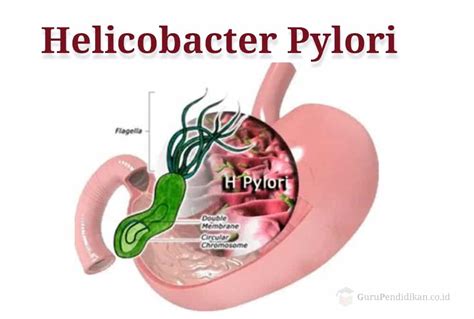 Penjelasan Ciri Ciri Helicobacter Pylori Dalam Biologi Gurupendidikan