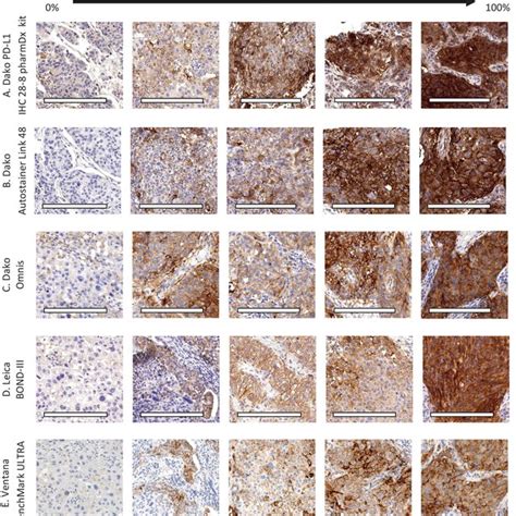 Pd L1 Immunohistochemistry Staining In Tonsil Positive Control Tissue