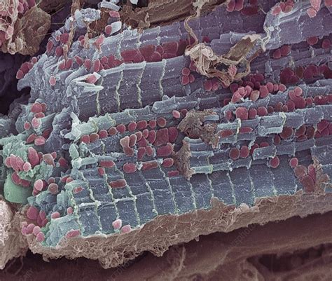 Cardiac Muscle Sem Stock Image P Science Photo Library