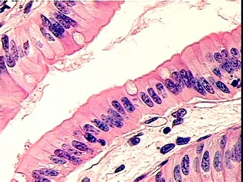 Simple Columnar Epithelium Microvilli