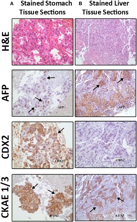 Comparable Hematoxylin And Eosin H E Staining And Immunostaining For