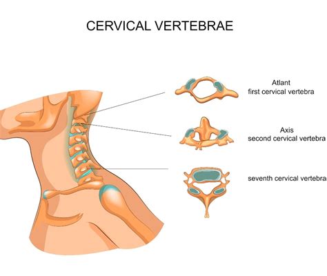 Colonna Cervicale Vertebre Cervicali