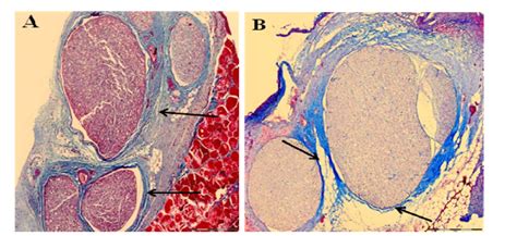 Photomicrographs Of Cross Sections Of Nerves And Surrounding Tissue