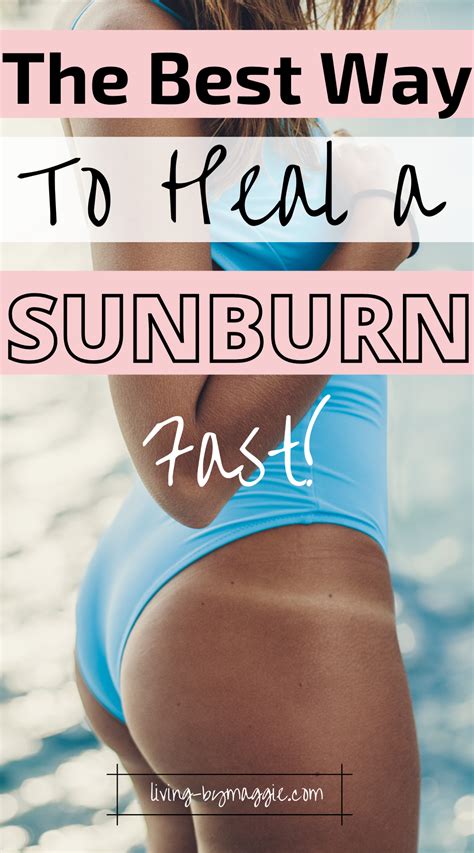 This Is The BEST Way To Treat A Sunburn Fast Best Sunburn Treatment