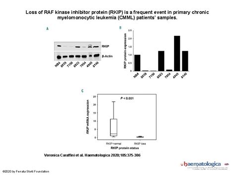 Loss Of Raf Kinase Inhibitor Protein Is Involved