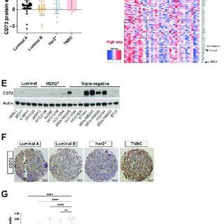 Abnormal Expression Of CD73 Correlates With A Poor Prognosis Of Breast