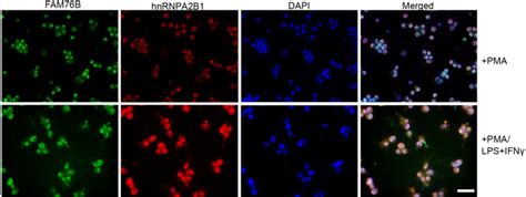 Fam76b Regulates Nf κb Mediated Inflammatory Pathway By Influencing The