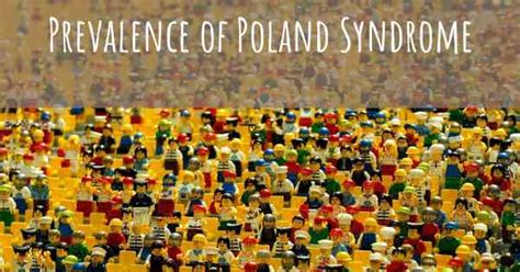 What is the prevalence of Poland Syndrome?