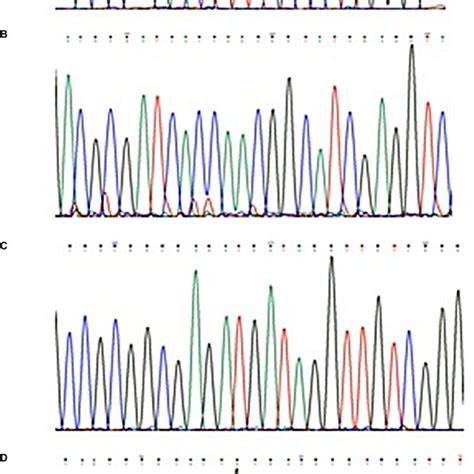 Representative Examples Of The DNA Sequencing Chromatograms Notes