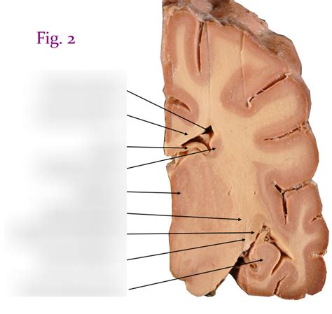 transverse brain section  diagram quizlet