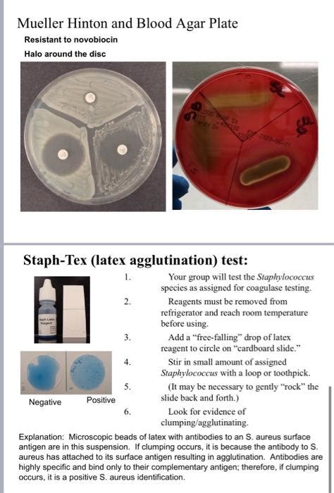 Solved Experiment 40 Identification Of Staphylococci