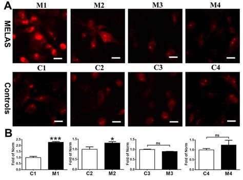 Elevation In Mitochondrial Superoxide In Melas Ins A A Download Scientific Diagram