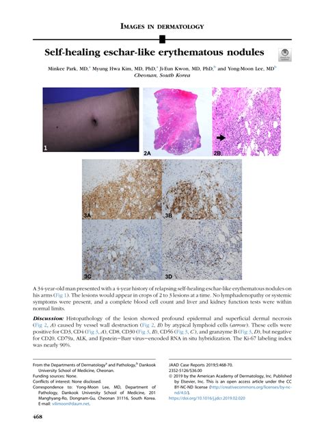 (PDF) Self-healing eschar-like erythematous nodules