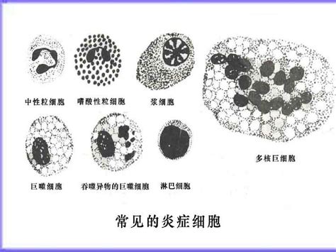 01炎症 病理学word文档在线阅读与下载无忧文档