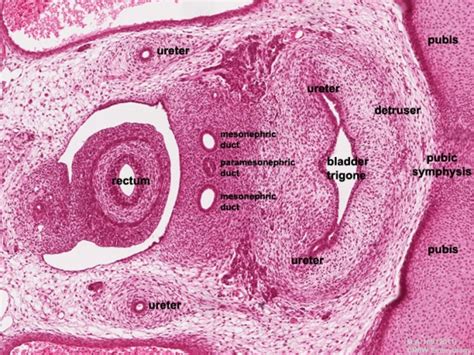 Bgd Lecture Sexual Differentiation Embryology