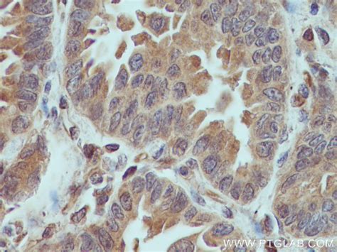 XIAP antibody 66800 1 Ig Proteintech 武汉三鹰生物技术有限公司