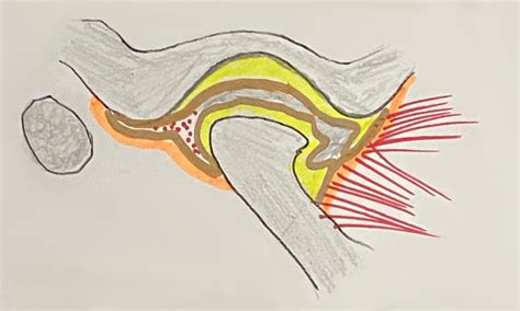 Tmj Pain And Temporomandibular Disorders Cairns Future Dental