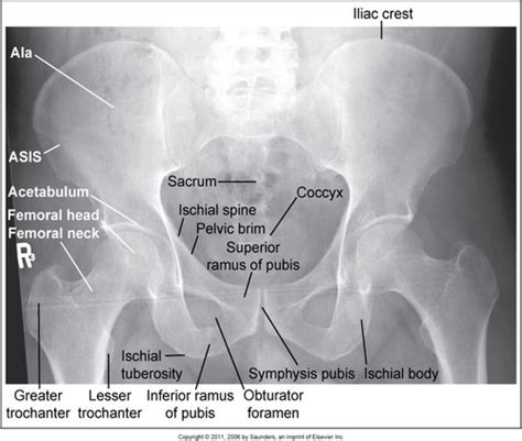 Unit Spine Sacrum Coccyx Sternum Ribs Flashcards Quizlet