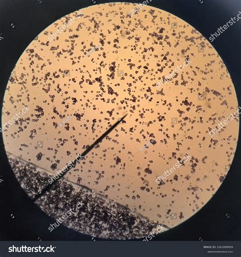 Maize Starch Granules Under Light Microscope Stock Photo 2261898009