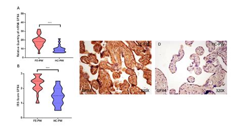 A GPX 4 MRNA Expression In Both The FE PW First Episode Of