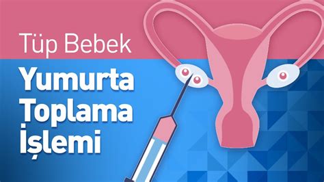 Yumurta Toplama Lemi Nedir T P Bebek Yumurta Toplama Lemi Nas L