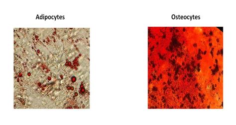 Characterization Of Human Umbilical Cord Vein Derived Mesenchymal Stem