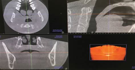 The Safe And Effective Use Of Cone Beam Computed Tomography