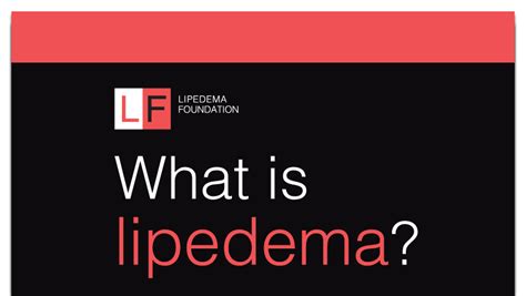 Lipedema Source Education And Resources For Lipedema In 2022