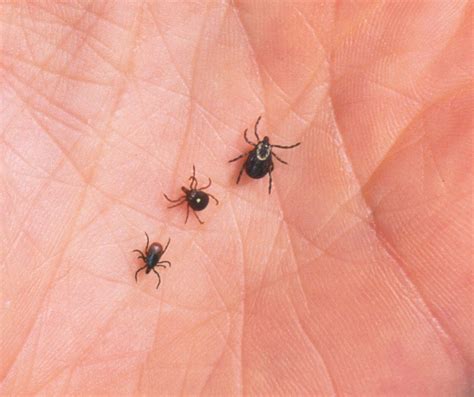 Alpha Gal Syndrome What Is The Incurable Meat Allergy Spread By Ticks