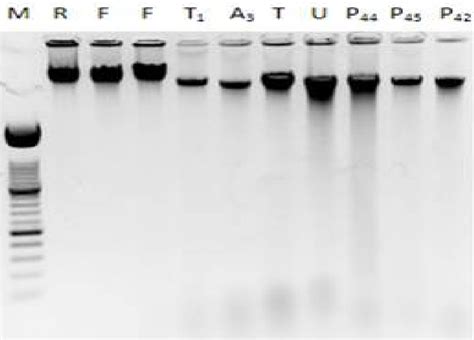 Agarose Gel Electrophoresis Of Extracted Genomic DNA 1 5 Isolated