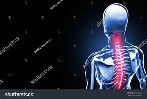 Painful Spine Vertebrae Pain Anatomy Concept Stock Illustration