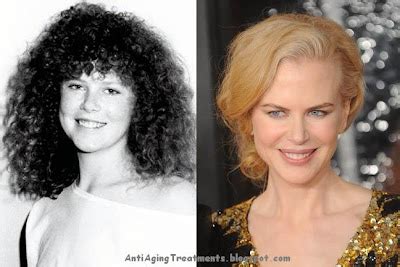 Anti Aging Treatments: Nicole Kidman Nose Reshaping Surgery, Boob Job ...