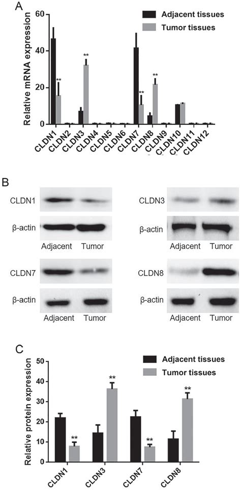 Expression Of CLDNs In Human Laryngeal Squamous Carcinoma And Adjacent