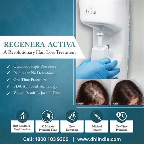 Regenera Activa Hair Loss Treatment Procedure Cost And Results