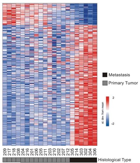 A Gene Expression Signature Correlated To Metastasis In Pancreatic