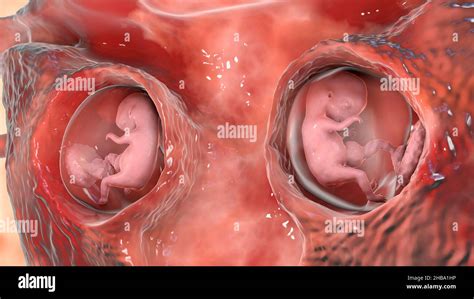 Identical Twins In The Womb At Weeks