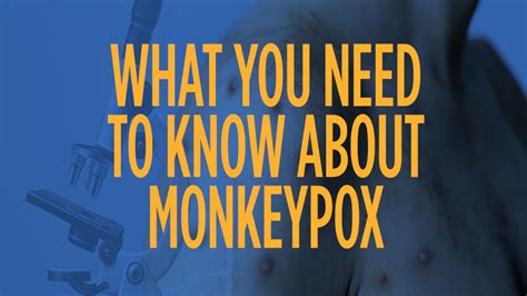 What Is Monkeypox Everything You Need To Know About The Origin