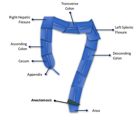 Low Anterior Resection Surgery — Love Your Buns